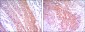HK2 Antibody
